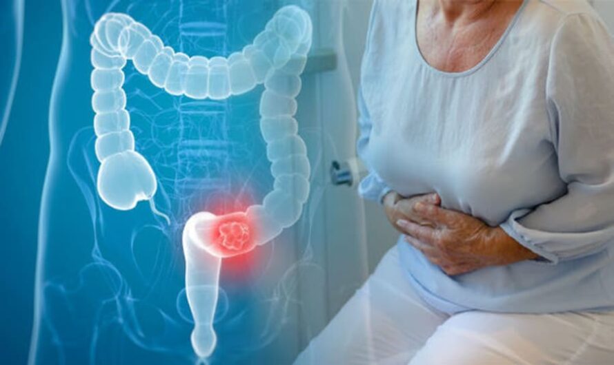 Diabetes Complications Increase the Risk of Early Death for Colorectal Cancer Patients