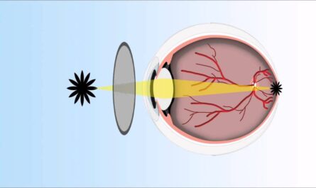 Myopia And Prebyopia Eye Drops
