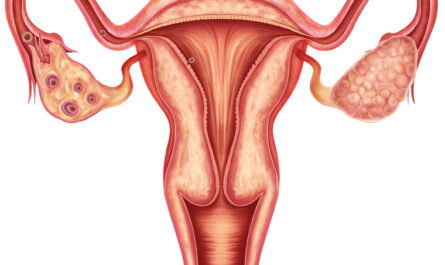 Polycystic Ovary Syndrome (PCOS) Treatment Market