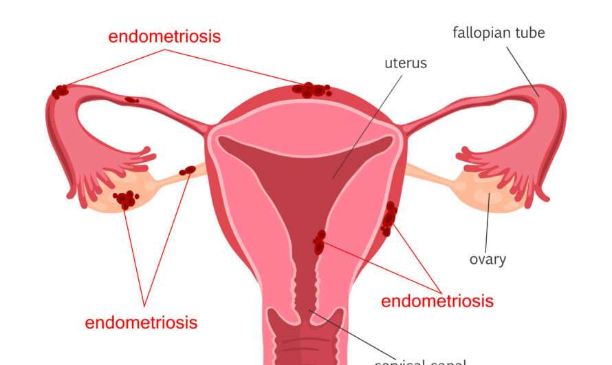 Lack of Evidence for Endometriosis Treatment: Calls for Improved Medical Education