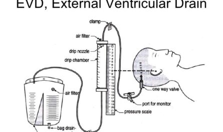 Global External Ventricular Drain