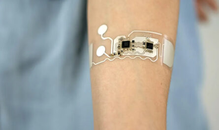 Wearable Patch